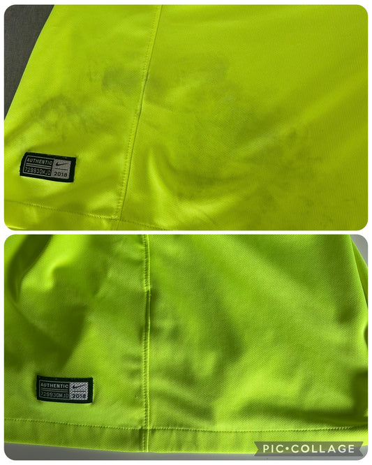 Stain Removal